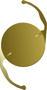 Toric intraocular lens design for correcting astigmatism during premium cataract surgery